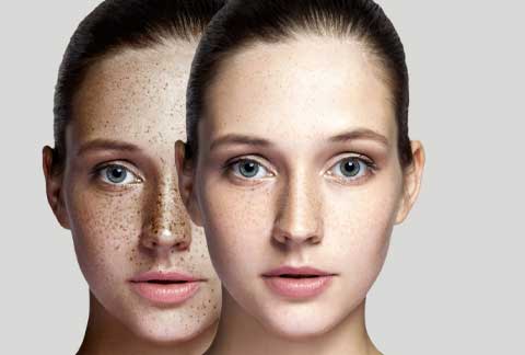skin-aging